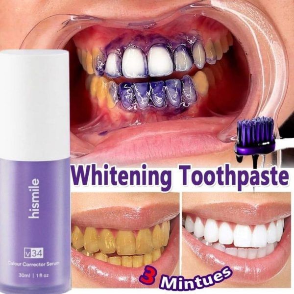 Teeth Brightening Hismiles V34