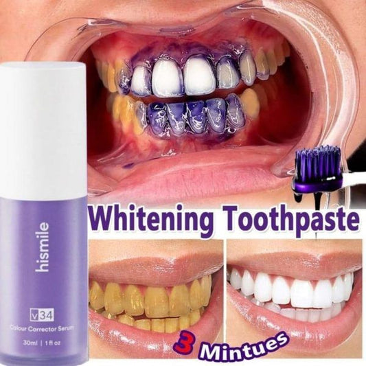 Teeth Brightening Hismiles V34